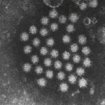 ノロウイルス電子顕微鏡写真
